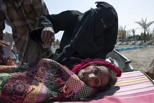 Una mujer enferma, en Yemen: la crisis humanitaria en el país lleva tres años