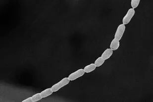 Esta fotografía captada al microscopio, facilitada por el Laboratorio Nacional Lawrence Berkeley en junio de 2022, muestra parte de una bacteria thiomargarita magnifica _la más grande que se conozca_ que fue descubierta en el archipiélago de Guadalupe, posesión francesa en el Caribe. (Olivier Gros/Universidad de las Antillas vía AP)