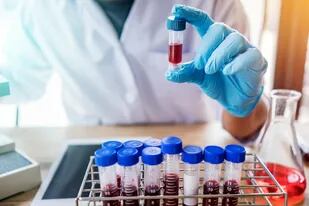 Un estudio de científicos españoles apuntó a los trasplantes de células madre como una posible vía para eliminar el VIH del organismo
