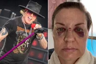 Una mujer acusa a Axl Rose de haberla lastimado en pleno recital de los Guns ‘N Roses