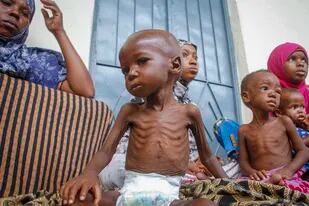 Un niño desnutrido de dos años, sentado junto a su madre (izquierda), desplazados por la sequía, en un centro para la desnutrición gestionado por Acción contra el Hamnre, en Mogadiscio, Somalia, el 5 de junio de 2022. Datos inéditos compartidos con The Associated Press muestran que al menos 448 personas murieron este año en los centros de tratamiento de la desnutrición solo en Somalia. (AP Foto/Farah Abdi Warsameh)