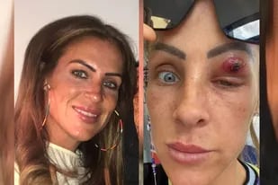 Una mujer descubrió una extraña mancha en su ojo y el resultado fue devastador.