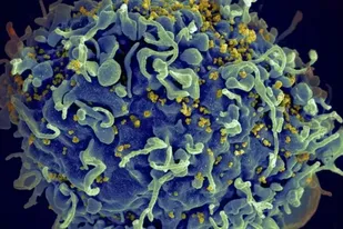 Esta electromicrografía muestra al virus VIH infectando una célula humana. La variante VB generó una mayor carga viral en pacientes que aún no reciben tratamiento.