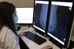 La mamografía permite detectar lesiones cuando todavía no son palpables