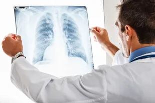 Los algoritmos de análisis de imágenes están demostrando ser más eficaces que los humanos a la hora de detectar cáncer de pulmón porque usa imágenes 3D