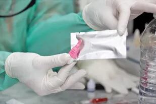 Las pruebas para detectar la presencia del coronavirus tienen un costo de entre 3000 y 8000 pesos