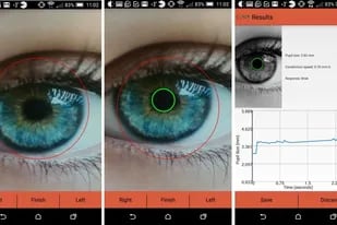 nvestigadores de la Universidad de California en San Diego han desarrollado una aplicación para teléfonos inteligentes para identificar, mediante primeros planos de los ojos, signos de alzhéimer, trastorno por déficit de atención e hiperactividad (TDAH) y otros trastornos neurológicos.