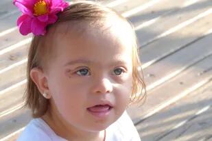 Rochi, tiene casi tres años, tiene síndrome de Down, y una insuficiencia renal crónica terminal.