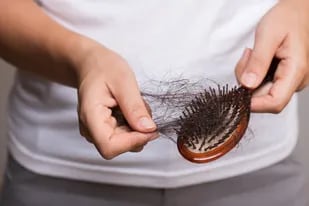 La caída de cabello no está incluida en el listado de afecciones posteriores al Covid-19 que elaboró el Centro para el Control y la Prevención de Enfermedades (CDC) estadounidense