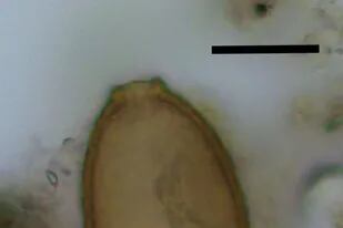 20/05/2022 Huevo microscópico de gusano capillariido de Durrington Walls. La barra de escala negra representa 20 micrómetros. POLITICA INVESTIGACIÓN Y TECNOLOGÍA EVILENA ANASTASIOU/UNIVERSITY OF CAMBRIDGE