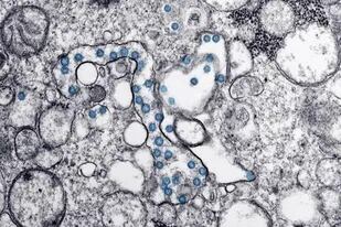 01/02/2023 Partículas del virus SARS-CoV-2, coloreadas en azul, en una imagen de microscopio de electrones. /.  Un trabajo liderado por el Centro de Biología Molecular Severo Ochoa (CBMSO, CSIC-UAM), y publicado en la revista 'Aging Cell', ha comprobado la implicación que tiene el envejecimiento celular en los efectos del Covid-19.  ESPAÑA EUROPA MADRID PRENSA, RADIO Y TELEVISIÓN SALUD CDC