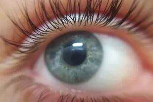 Científicos y oftalmólogos advierten que la infestación con un diminuto parásito podría originar o agravar la sequedad, irritación y prurito ocular que afecta hasta a un 60% de la población