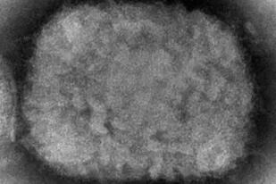 Esta imagen de microscopio de 2003 proporcionada por los Centros para el Control y la Prevención de Enfermedades muestra un virus de la viruela símica, obtenido de una muestra relacionada con un brote en perros. (Cynthia S. Goldsmith, Russell Regner/CDC vía AP)