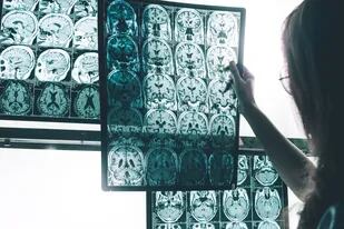 Ningún tratamiento experimental ha logrado revertir el Alzheimer