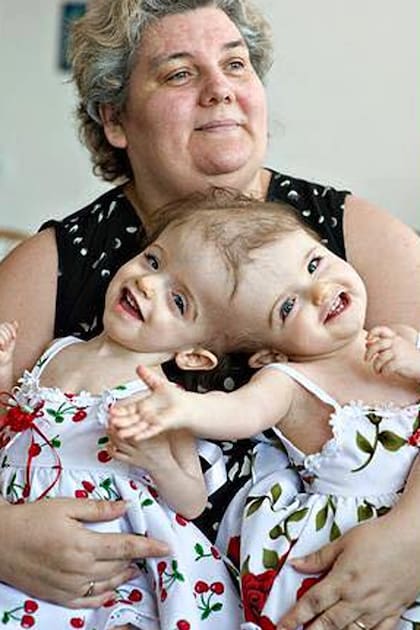 Las hermanas siamesas Tatiana y Kirsta Hogan, cuando eran bebés, junto a su abuela