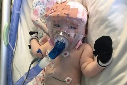 Con solo seis meses tuvo que ser aislada y conectada a un respirador artificial