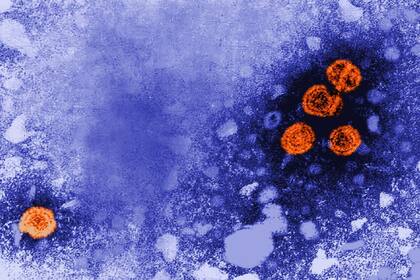 01/01/1970 Imagen de microscopía electrónica de transmisión coloreada digitalmente revela la presencia de viriones de la hepatitis B (de color naranja). POLITICA SALUD CDC/DR. ERSKINE PALMER