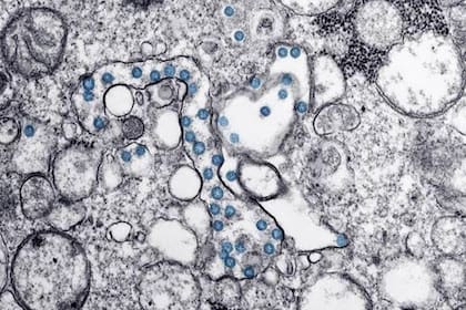 01/02/2023 Partículas del virus SARS-CoV-2, coloreadas en azul, en una imagen de microscopio de electrones. /.  Un trabajo liderado por el Centro de Biología Molecular Severo Ochoa (CBMSO, CSIC-UAM), y publicado en la revista 'Aging Cell', ha comprobado la implicación que tiene el envejecimiento celular en los efectos del Covid-19.  ESPAÑA EUROPA MADRID PRENSA, RADIO Y TELEVISIÓN SALUD CDC