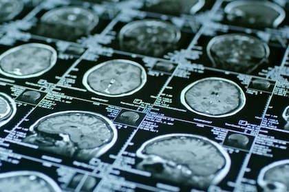 02-09-2019 Imágenes de resonancia magnética de un cerebro SALUD UNIVERSITY OF MISSOURI