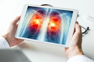 En medio del aumento de casos del cáncer más letal, la oncología avanza con terapias prometedoras