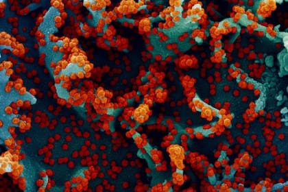 06-10-2021 Micrografía electrónica de barrido coloreada de una célula infectada con SARS-CoV-2. POLITICA SALUD NIAID