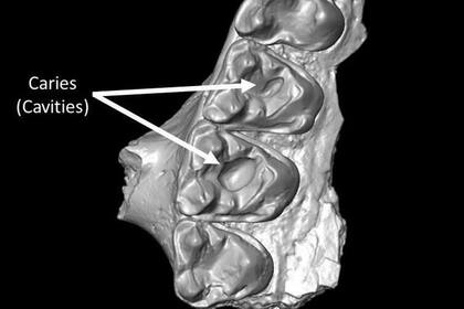 09-09-2021 Parte del maxilar superior de Microsyops latidens con dos caries (cavidades). POLITICA INVESTIGACIÓN Y TECNOLOGÍA KEEGAN SELIG