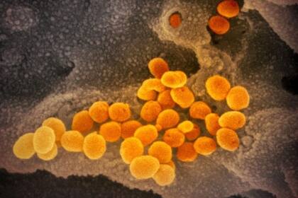 16-04-2021 Esta imagen de microscopio electrónico de barrido muestra el SARS-CoV-2 (naranja), el virus que causa la COVID-19, aislado de un paciente en EE.UU. El virus emerge de la superficie de las células (gris) cultivadas en el laboratorio. POLITICA SALUD NIAID