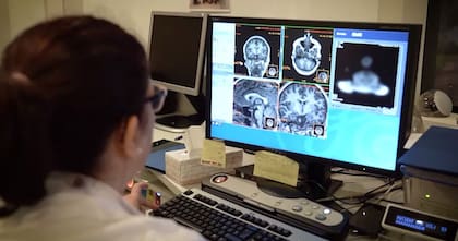 18/04/2024 Detectan con un análisis de sangre un mecanismo clave en el desarrollo del Alzheimer. La Fundación Centro de Investigación de Enfermedades Neurológicas (CIEN), dependiente del Instituto de Salud Carlos III y respaldada por la Fundación Reina Sofía, avanza en el diagnóstico preciso del Alzheimer mediante biomarcadores sanguíneos y ha confirmado la conexión entre los niveles en sangre de la proteína fibrilar glial ácida (GFAP, por sus siglas en inglés) y el desarrollo de la enfermedad, estableciendo por primera vez en humanos la relación entre esta proteína y la activación de los astrocitos en el cerebro, clave en los procesos inflamatorios de la patología. SALUD CIEN