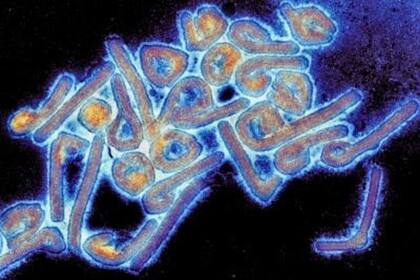 20/08/2014 Virus de Marburgo ESPAÑA EUROPA MADRID SALUD THOMAS GEISBERT/UNIVERSIDAD DE TEXAS MEDICAL BRANC