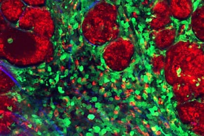 21/02/2023 Los componentes de un tumor. SALUD IBBTEC