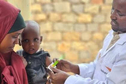 22/11/2023 Un médico de World vision atiende a un niño en Somalia. SOCIEDAD WORLD VISION