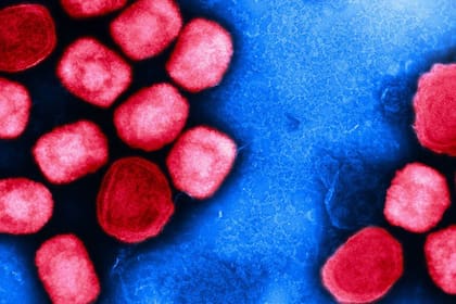 25/08/2022 Micrografía electrónica de transmisión coloreada de partículas del virus de la viruela del mono (rojo) cultivadas y purificadas a partir de un cultivo celular. SALUD NIAID