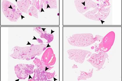 26-11-2021 En comparación con un control (paneles de la izquierda), el tratamiento con C26 (paneles de la derecha) reduce el número de tumores metastásicos en los pulmones de ratones inyectados con células escamosas de cabeza y cuello. SALUD KHALIL ET AL