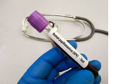 27/09/2023 Virus del Papiloma Humano (VPH) SALUD DOCOR