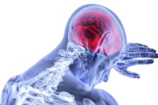 AIT: el Hermano Menor del Accidente Cerebrovascular