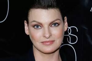 Linda Evangelista habló sobre el tratamiento estético que la dejó “permanentemente deformada”