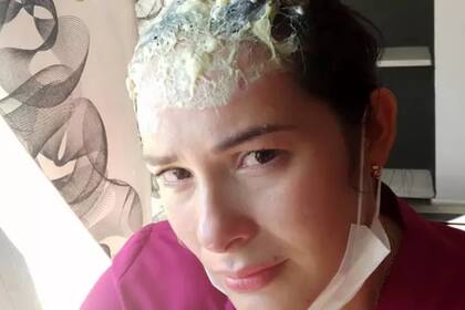 A causa del ataque, sufrió quemaduras