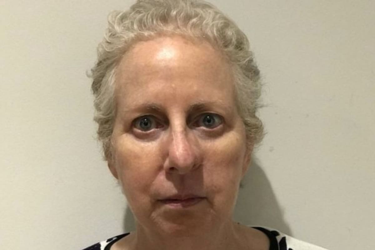 A Elizabeth le dijeron que tenía un tipo de cáncer común en la nariz