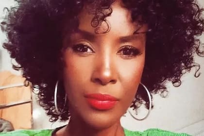 A Isser le dijeron que un lunar que le habían quitado era en realidad cáncer de piel