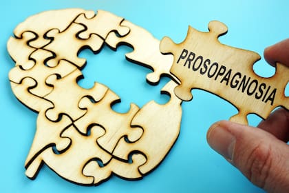 A las personas con prosopagnosia les cuesta obtener un diagnóstico confirmado