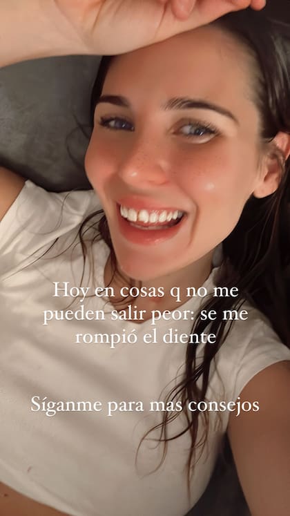 A Mina Bonino se le rompió un diente y lo compartió con sus seguidores