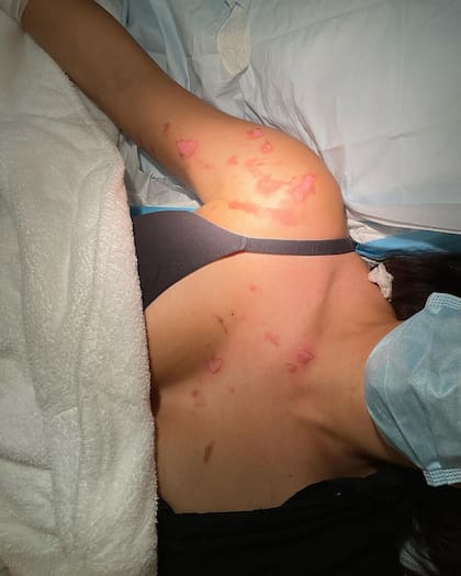 A pesar del dolor, Eva De Dominici continuó trabajando mientras se sometía a las curaciones