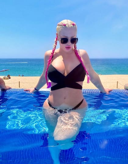 A sus 18 años Serena se hizo la primera cirugía