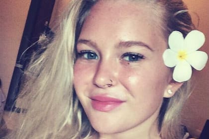 Acostumbrada a inyectarse relleno en los labios desde muy joven, Adriana afirma que ahora pensará dos veces cada intervención