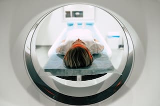 Un oncólogo lo explica: "Hay más diagnósticos, pero menos muertes"