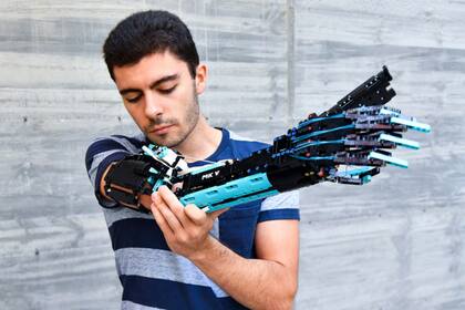Actualmente, sus prótesis son mucho más sofisticadas y cuenta con el respaldo de LEGO para crearlas