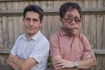 Adam Pearson junto a su hermano, Neil