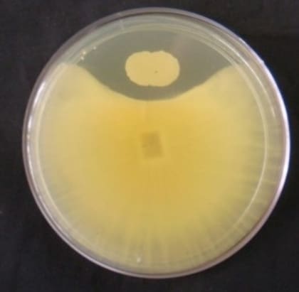 Además de la biotransformación, existen otros métodos que se basan en el uso de microorganismos para abordar la contaminación con micotoxinas de distintas familias en la industria alimentaria; por ejemplo, la bioadsorción