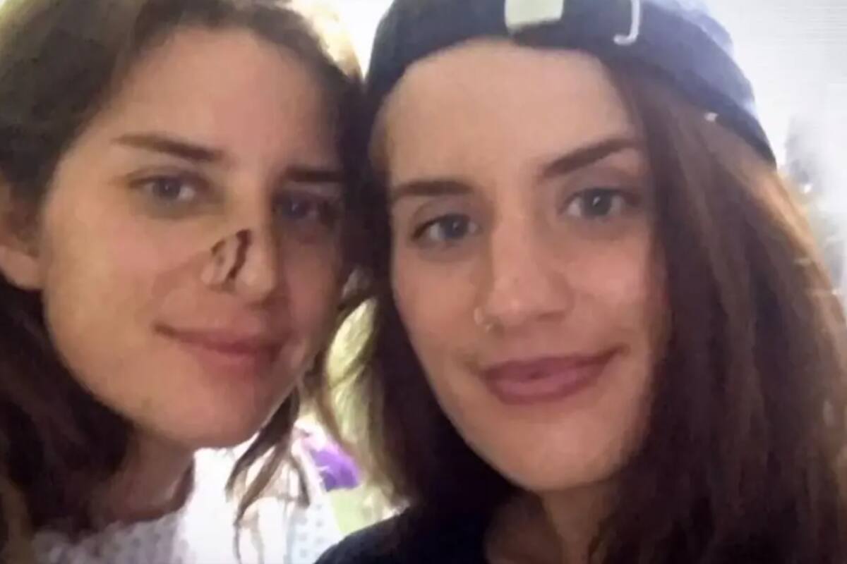 Además del corte en su nariz, Melissa Laurie sufrió mordidas en distintas partes del cuerpo y una infección sanguínea. Fuente: ITV.