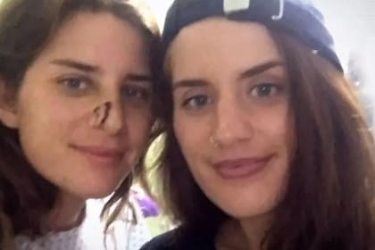 Además del corte en su nariz, Melissa Laurie sufrió mordidas en distintas partes del cuerpo y una infección sanguínea. Fuente: ITV.